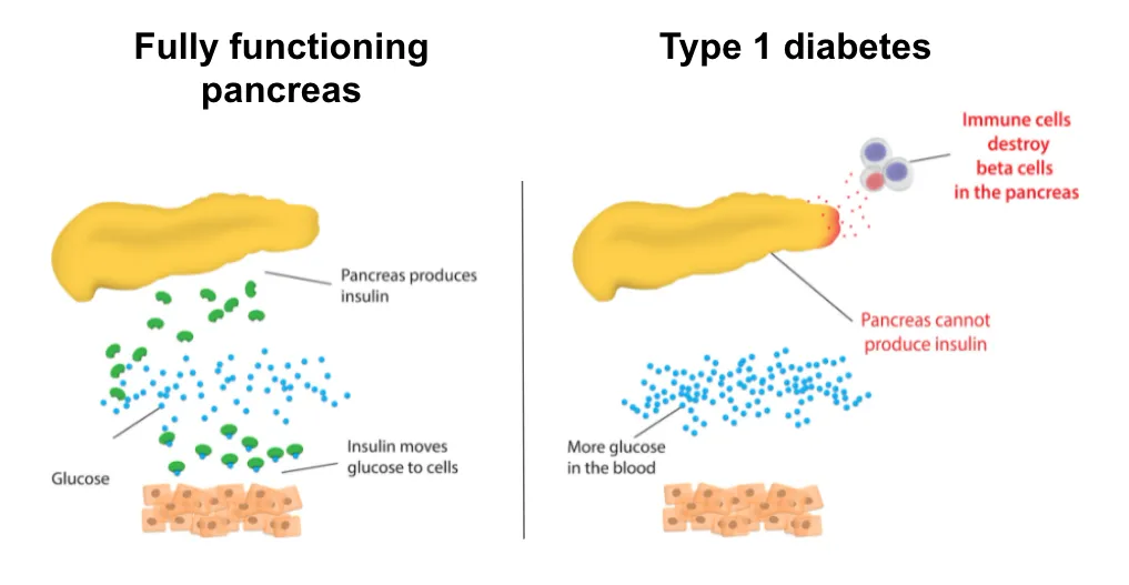 9428 honeymoon period duration
